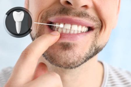 a man is pointing at a tooth in his mouth . a man is pointing at a tooth in his mouth .