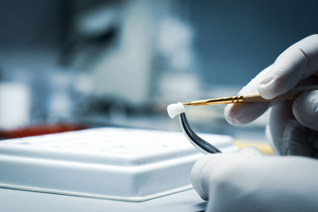 Dental Crowns In Fort Myers: How They Protect And Restore Damaged Teeth